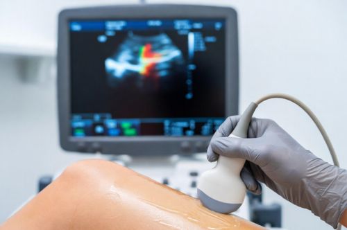 Допплерография