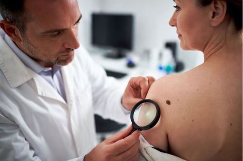 Родинки: почему они появляются и что с ними делать? 